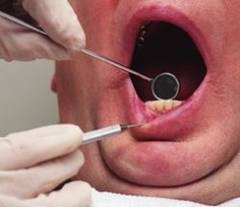 Sangerarea gingiilor in timpul sarcinii